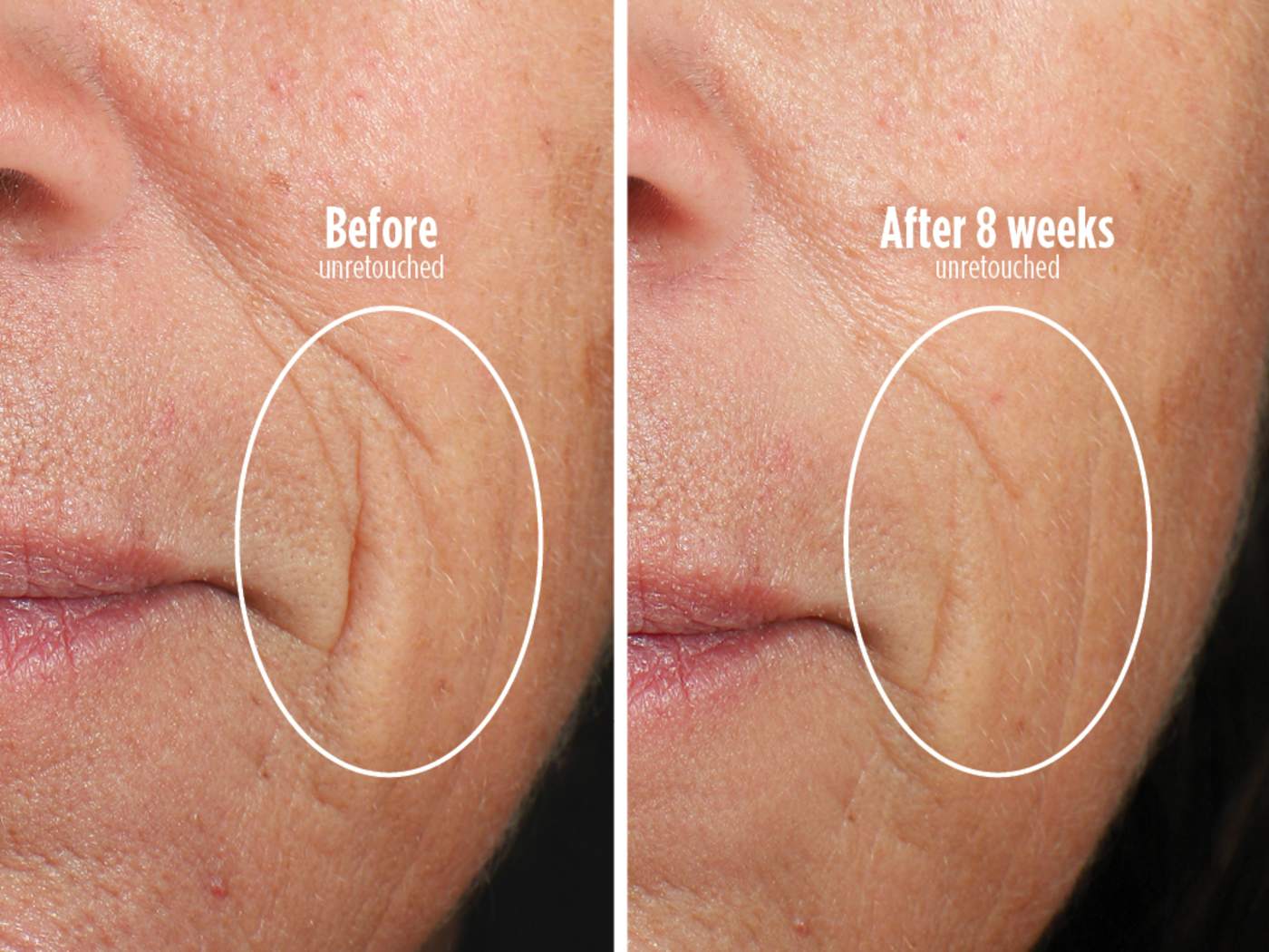 Before and after 8 weeks - better aging