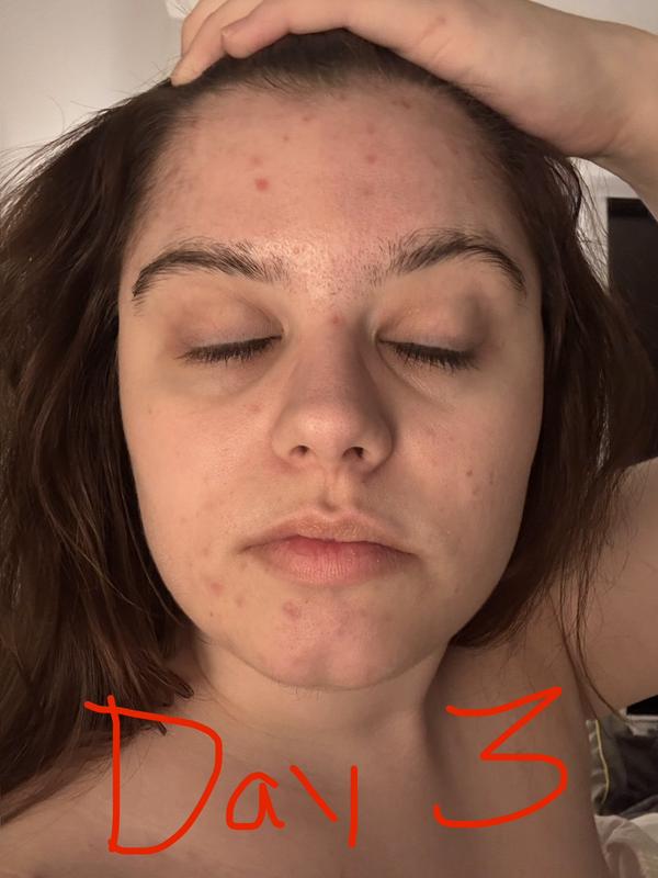 Customer review photo