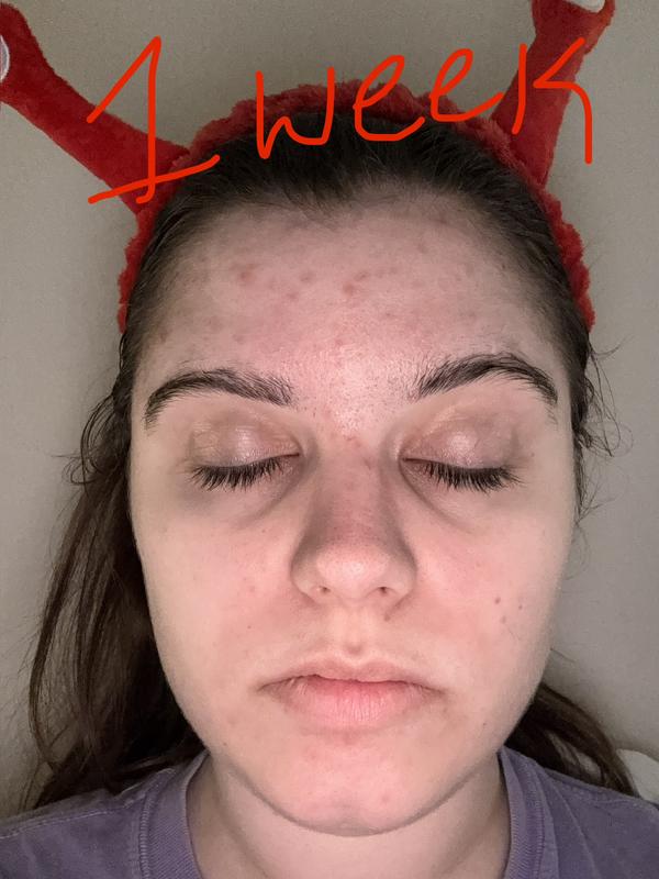 Customer review photo