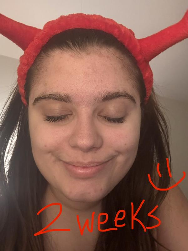 Customer review photo